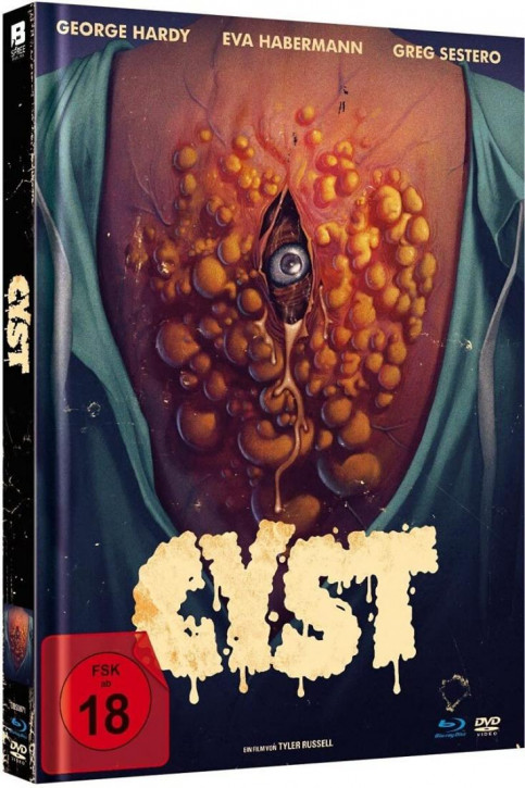 Cyst - Mediabook [Blu-ray+DVD]